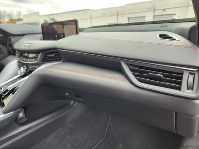 2025 Acura TLX A-Spec Package SH-AWD