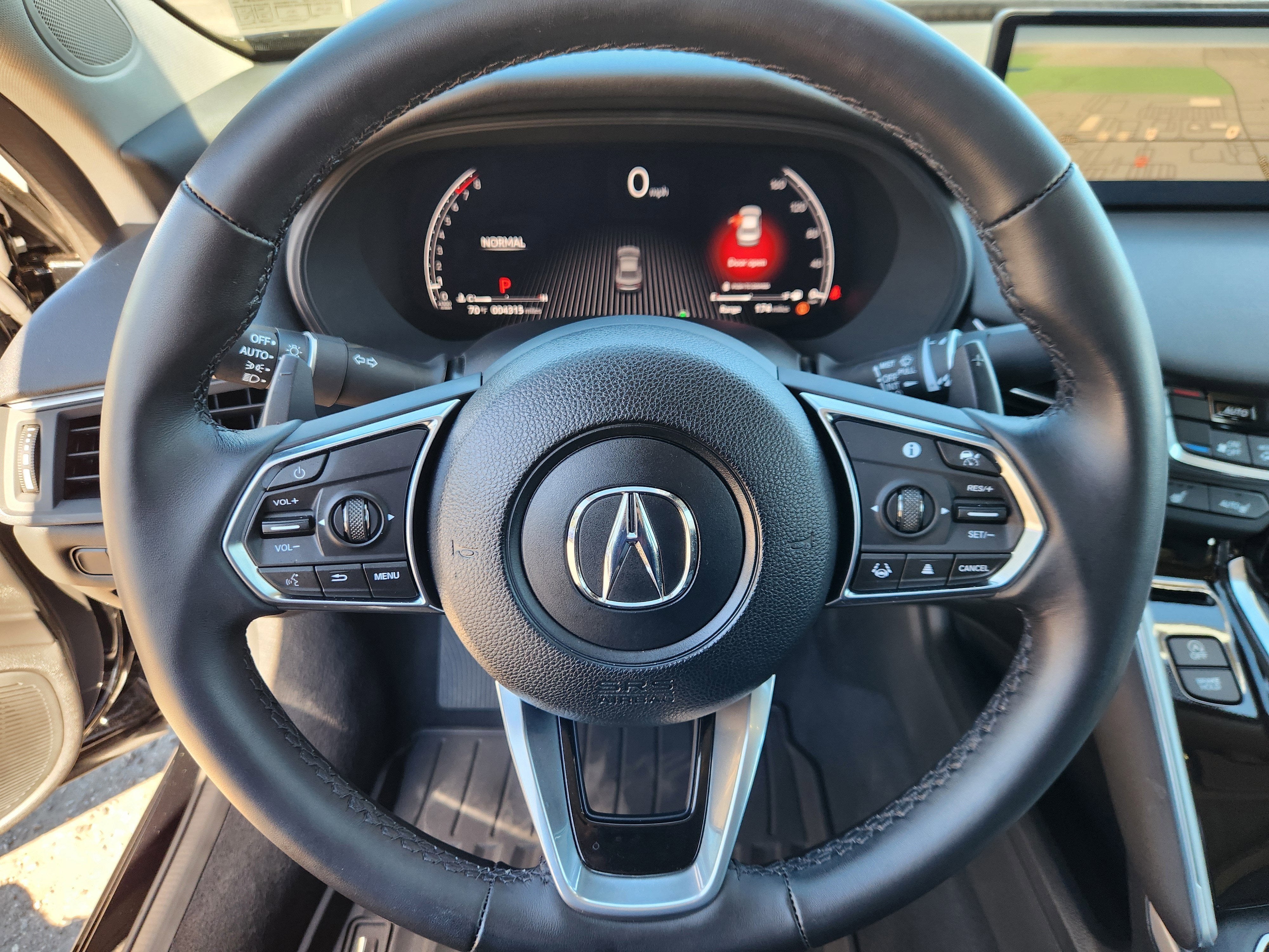 2025 Acura TLX Technology Package